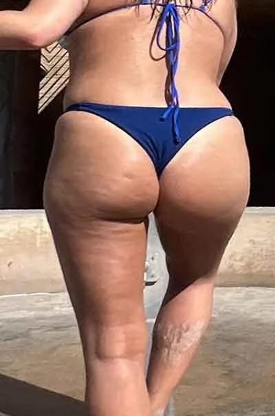 Linn Skålevik